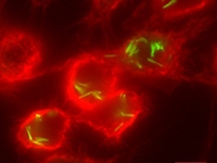 The bacteria that causes tuberculosis is infecting macrophages, the host cell that plays a key role in defense against the bacteria. The bacteria that causes tuberculosis infecting macrophages